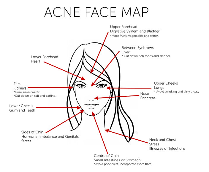 acne-face