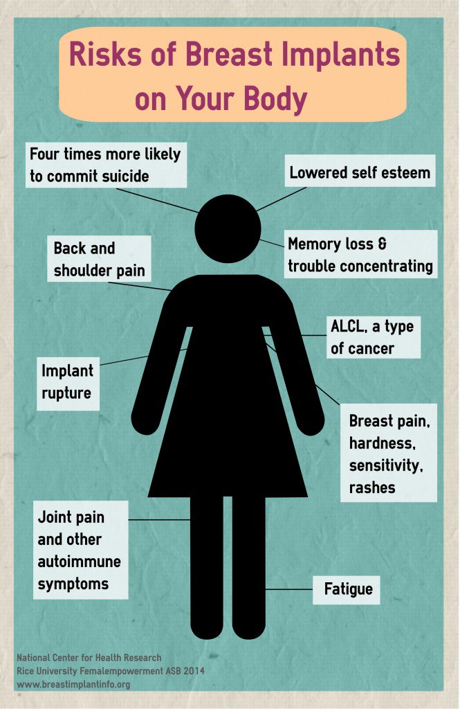 breastimplantrisks-2-665x1024