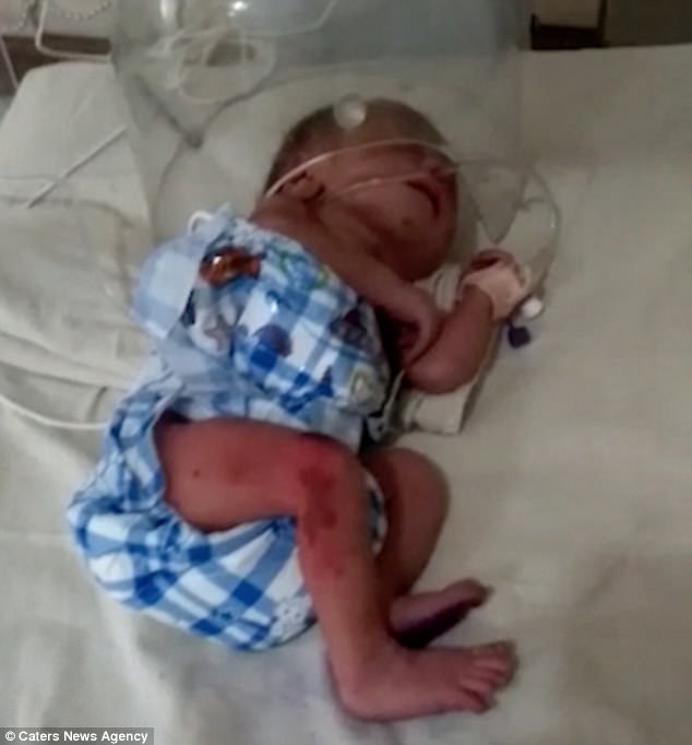 Rescued: The severely underweight baby is now in critical condition in hospital 