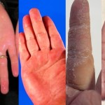 The Palm of your Hands can reveal the hidden ailments and warn about your health