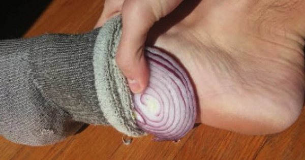 onion socks